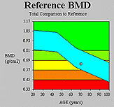 ���ʁi�O���t�\���j