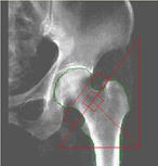 �Ҋ֐ߐ��ʑ�