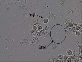 細菌 尿 検査