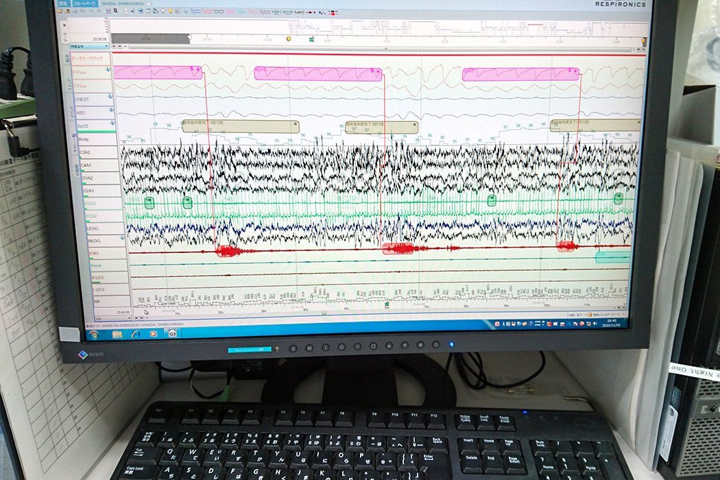 睡眠時無呼吸(PSG)検査
