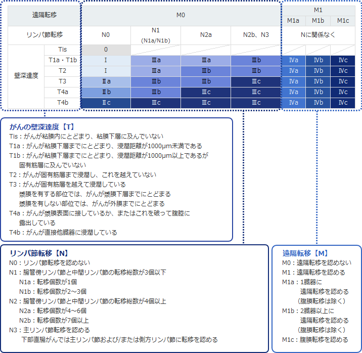 大腸がんのステージ