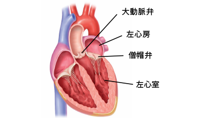 僧帽弁閉鎖不全症とは