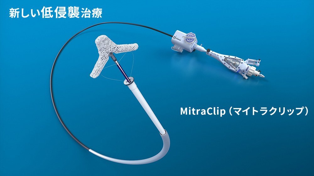 新しい低侵襲治療MitraClip