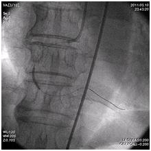 放射線部：愛媛県立南宇和病院